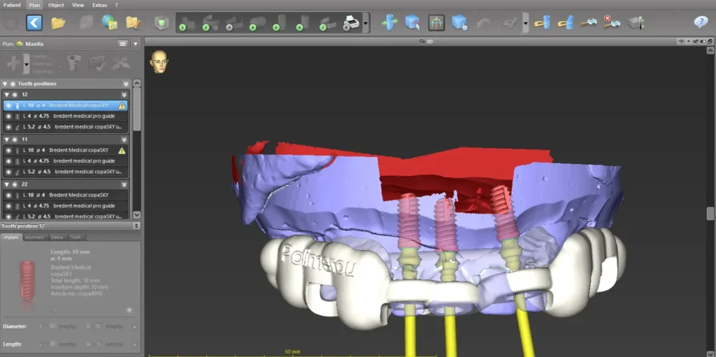 guided emfyteusi 1